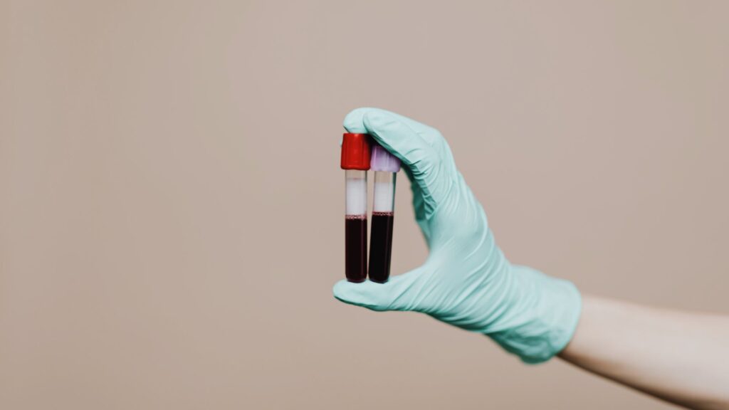 Hand hält 2 Bluttest-Röhrchen - moderne Diagnostik zur Auswahl von Supplements