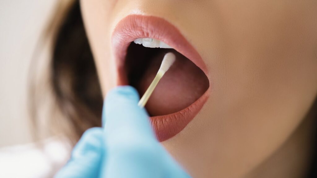 Frau lässt DNA-Test mit Wangenabstrich durchführen – genetische Analyse für personalisierte Gesundheit und Methylierung