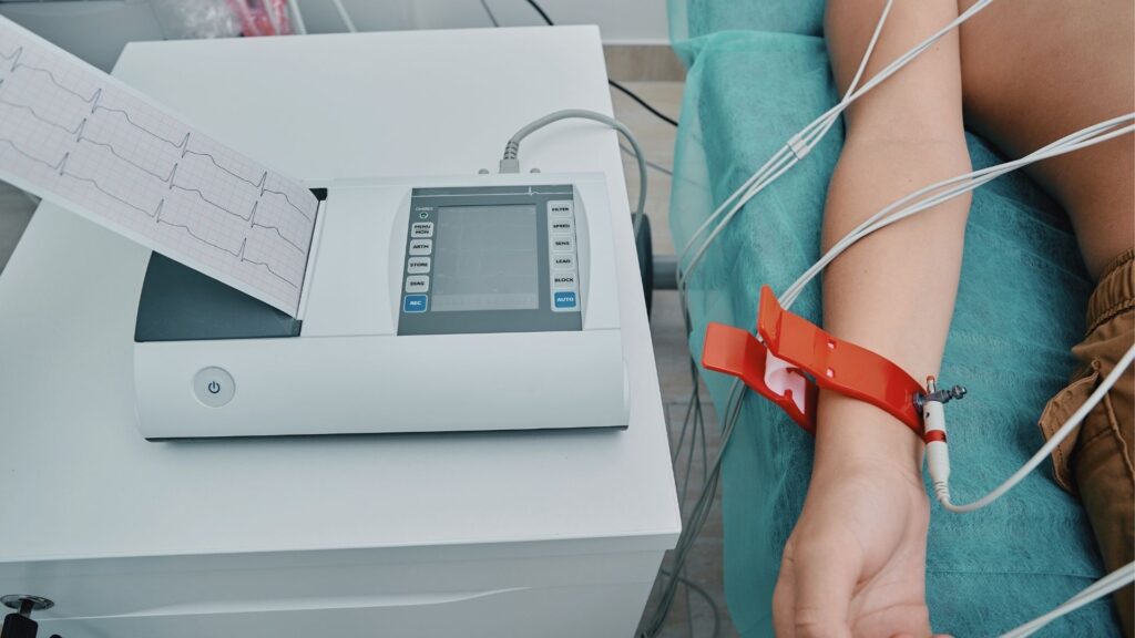 Person liegt angeschlossen an ein EKG im Krankenhaus - Diagnose Herzmuskelentzündung