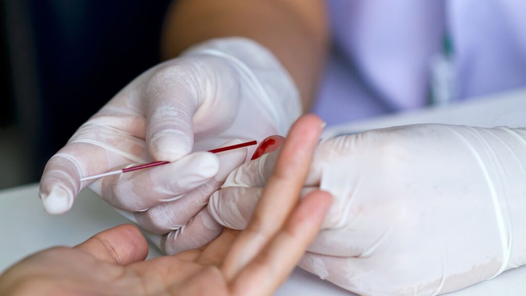 Bluttest mit Fingerstich als Methode zur Bestimmung der Fettsäure-Indikatoren